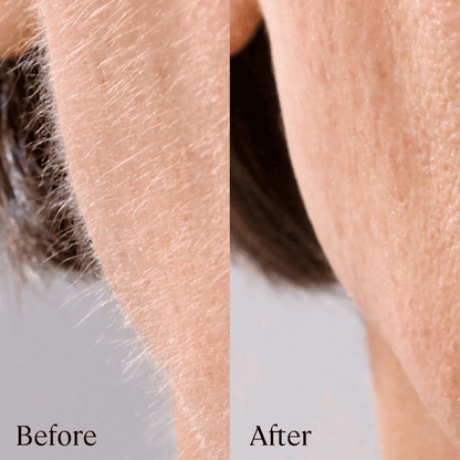 Sonicsmooth Clear Refill